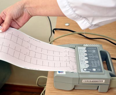 ECG-EKG printer