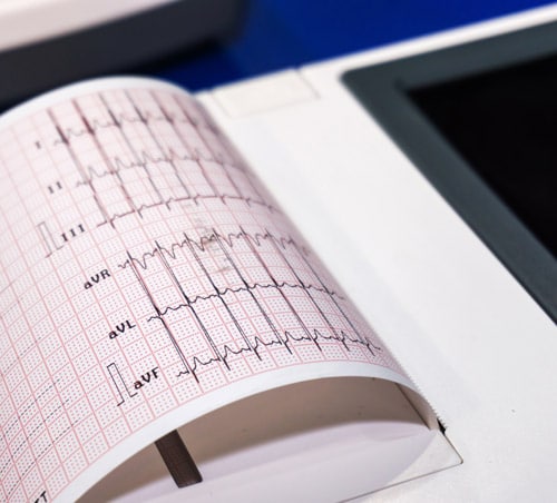 healthcare printout from a ECG device